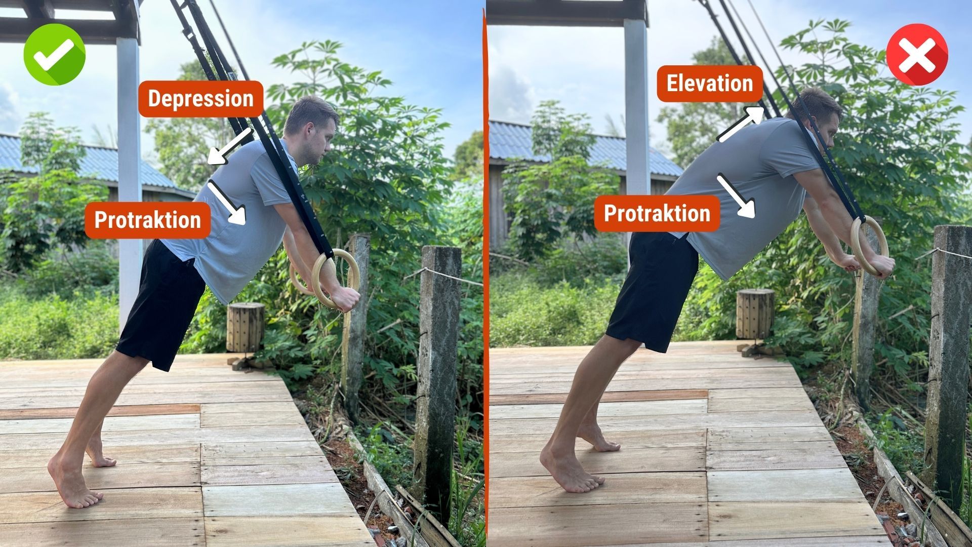 Elevation Depression Fehlerbild.jpg